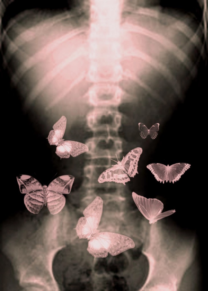 Бабочки в моем животе 